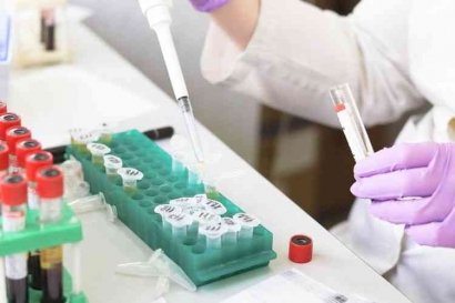 Periksa Urin Bisa Jadi Alat Pemantau Berbagai Penyakit